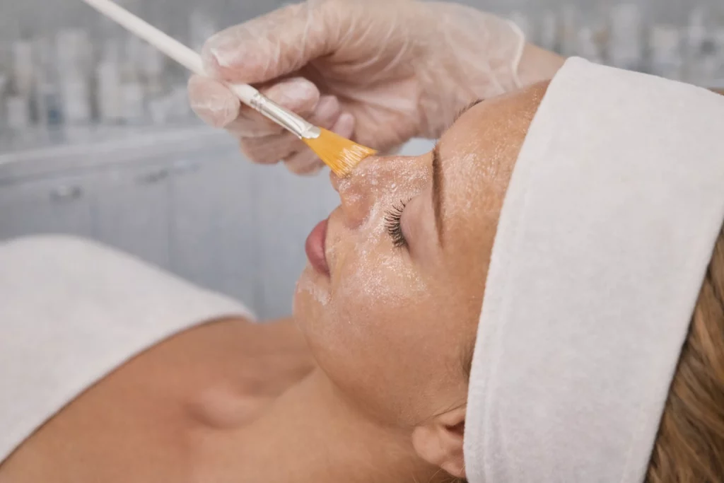 Peeling chimico: rinnovamento e rigenerazione della pelle a Roma